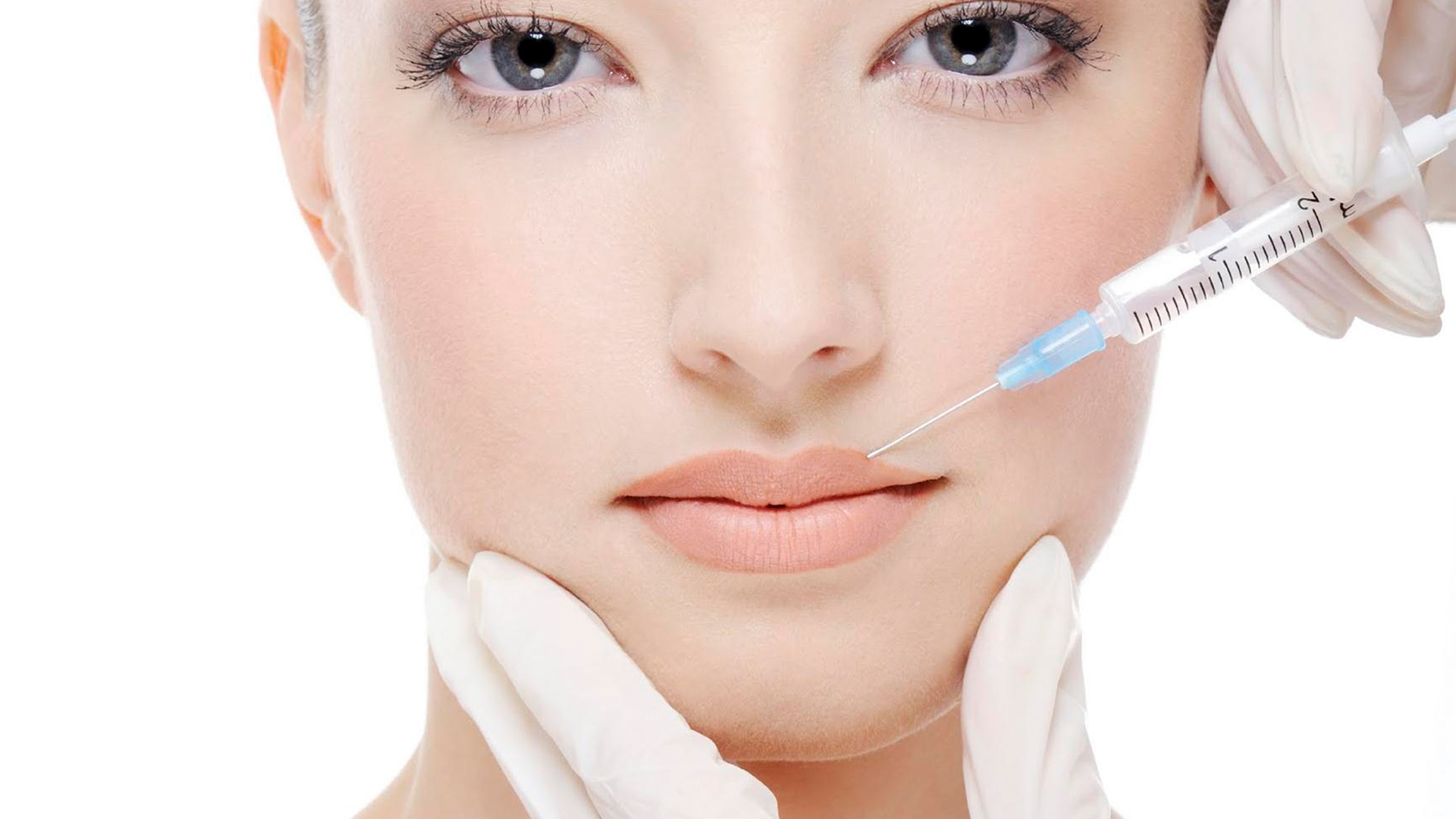 Preenchimento Orofacial com Ácido Hialurônico